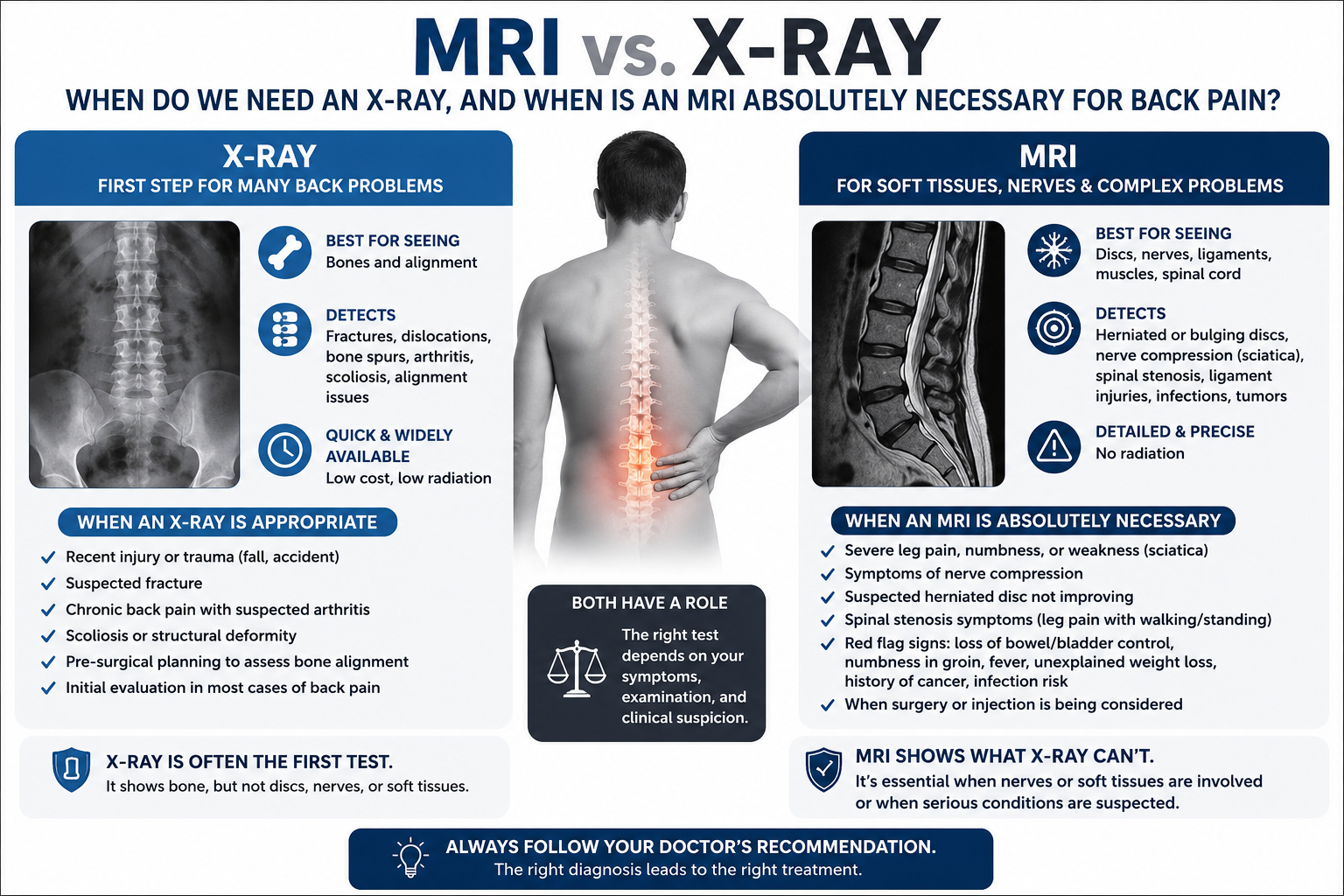 MRI vs. X-Ray: When do we need an X-ray, and when is an MRI absolutely necessary for back pain?